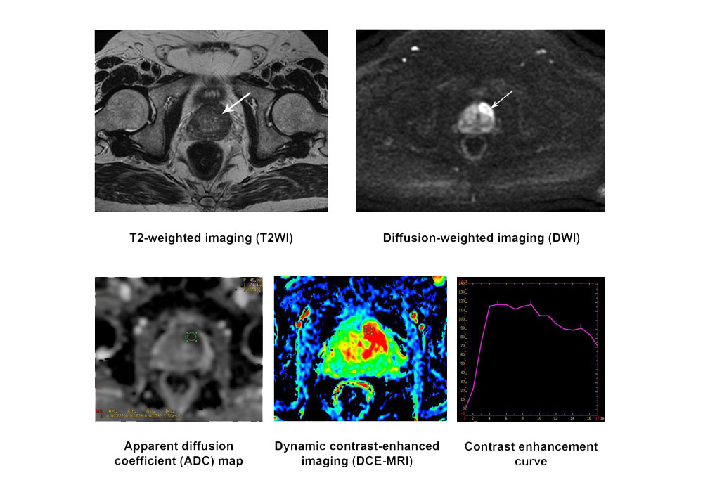 Μαγνητικές τομογραφίες